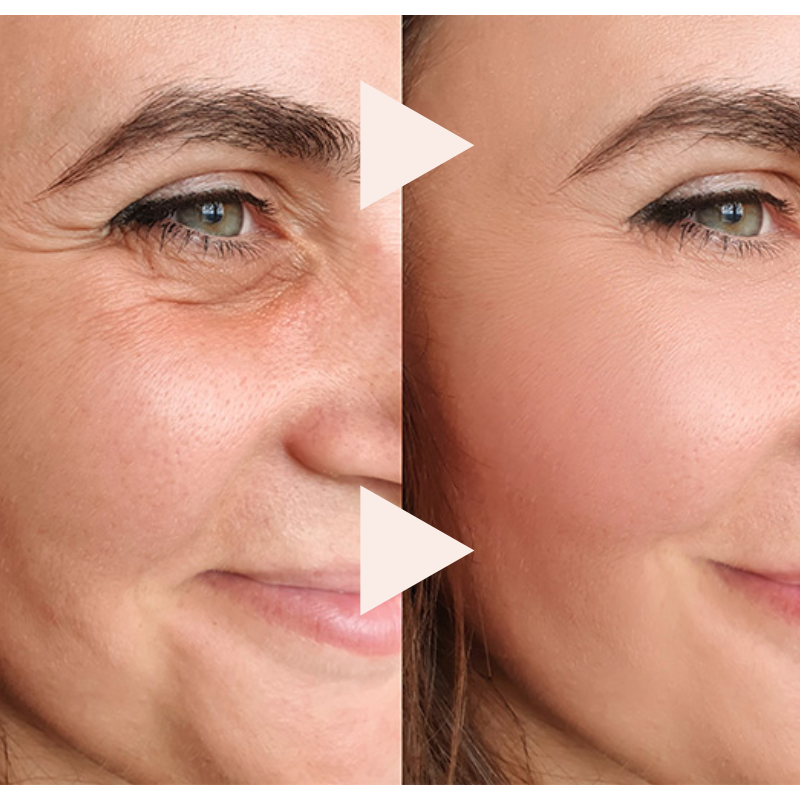 Final 3 Hours: 70% OFFđ„The Express Anti-Wrinkle â Instant Lifting Effect