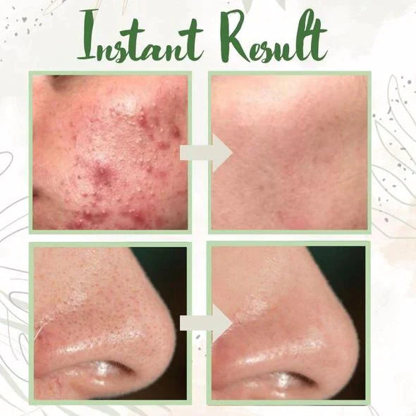 🌿Green Tea Deep Cleanse Mask - Gentle. Effective. All-Natural